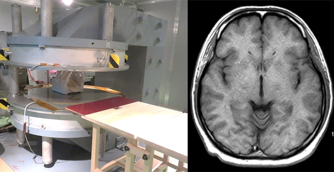 図1 MgB2超電導磁石の外観および撮像した人体頭部の断面画像の一例