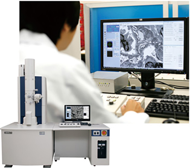 [Electron Microscopes Field] Transmission Electron Microscopes (HT7800) 
