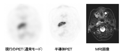 [摜]PETE:ŝods(ʏ탂[h)A:̂odsAE:MRI