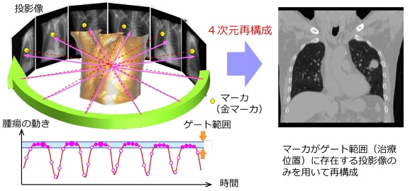 [摜]}1. 4CBCT̊Tv