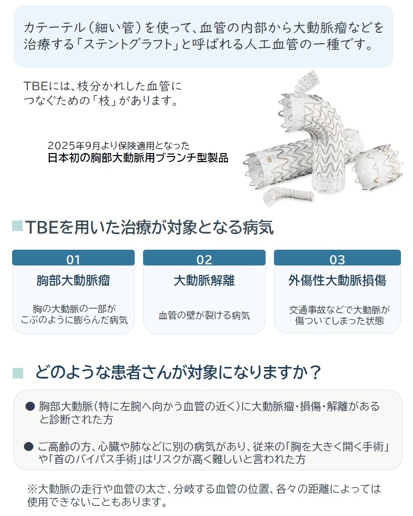 TBEとは