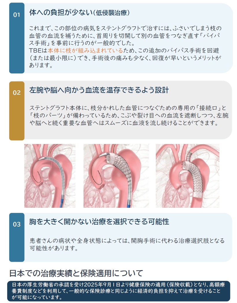 TBEの3つの大きなメリット