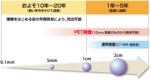 [画像]ガンの大きさと発見可能時期