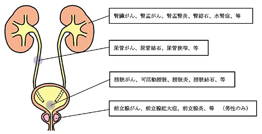 かん と ん ほう けい 泌尿器 科