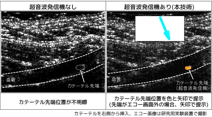 超音波発信機ありの場合、カテーテル先端位置を色と矢印で提示する。