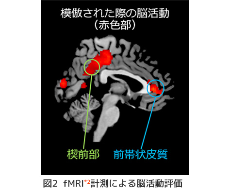 fMRI計測による脳活動評価