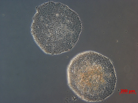 ヒト多能性幹細胞（iPS細胞）<br />Human induced pluripotent stem (iPS) cells